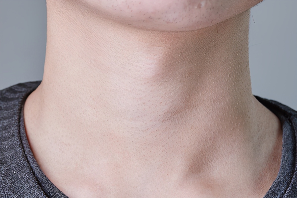 脖子上有小肉粒不处理可以吗,脖子上的透明小肉粒怎么去除