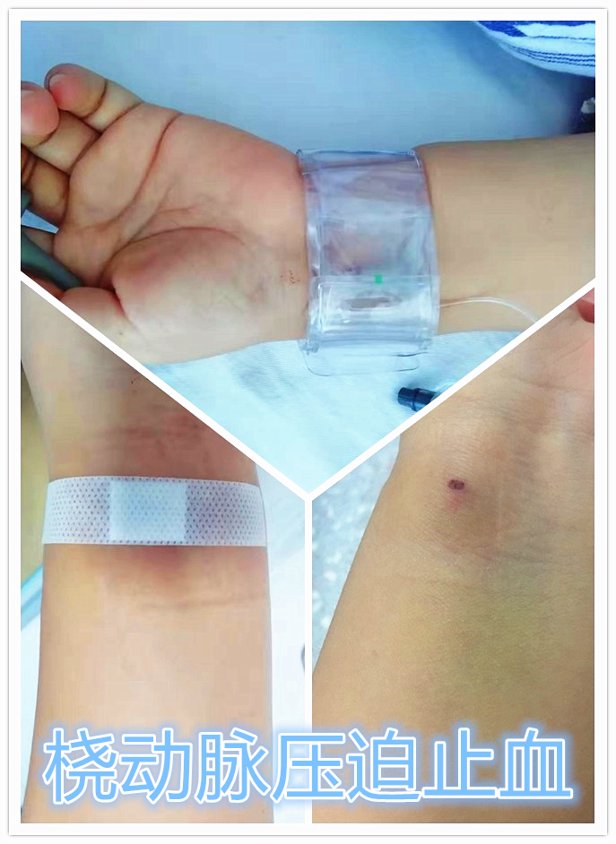 宫外孕保守治疗显示子宫腺肌症,子宫腺肌病保守治疗无效怎么办