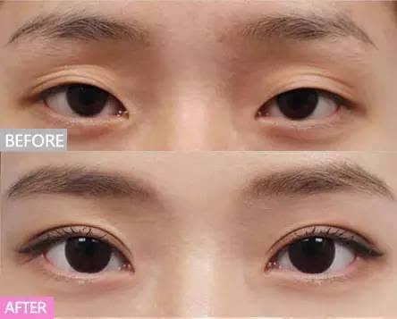 割双眼皮真的有必要吗知乎,割双眼皮是不是非要画眼影才好看