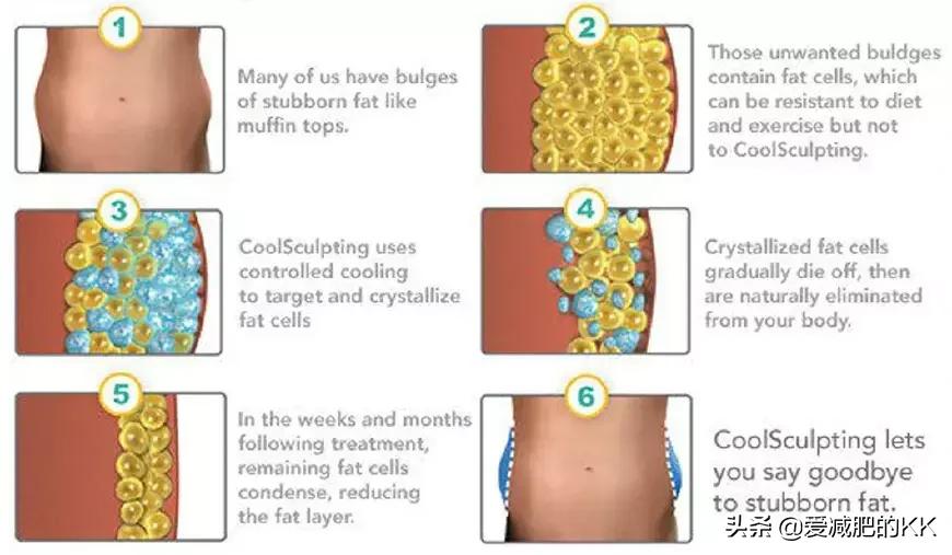 奇奇怪怪的减肥吃法,冷冻脂肪减肥法