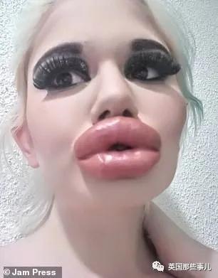 20次整容成功的女人,20次丰唇