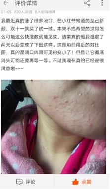 爆痘闭口做什么项目,爆闭口怎么办