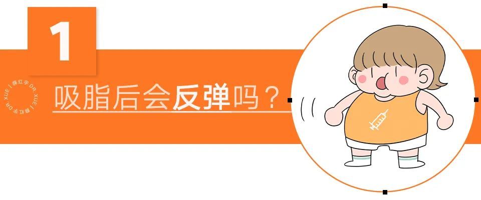 吸脂须知,吸脂必知