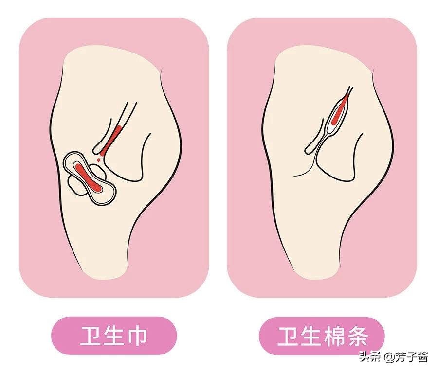 第一次用卫生棉条再加卫生巾吗,第一次用卫生棉条选择