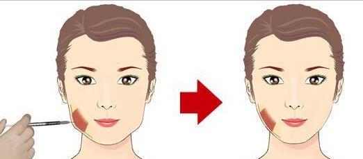 缺牙长期一侧咀嚼嘴巴倾斜,缺牙对咀嚼的影响