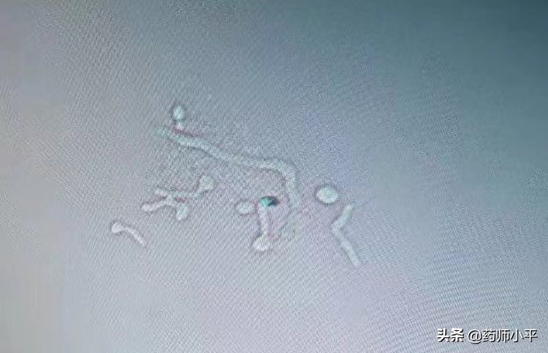 外阴瘙痒老是怀疑自己得了什么病,外阴瘙痒科普