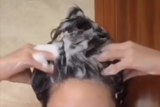 头发天天洗的很干净还是很痒,头发痒跟有虫子爬似的是怎么回事