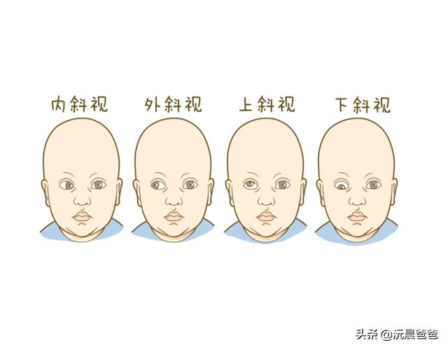 新生儿脑瘫的10个征兆图片,新生儿脑瘫一般是什么原因引起