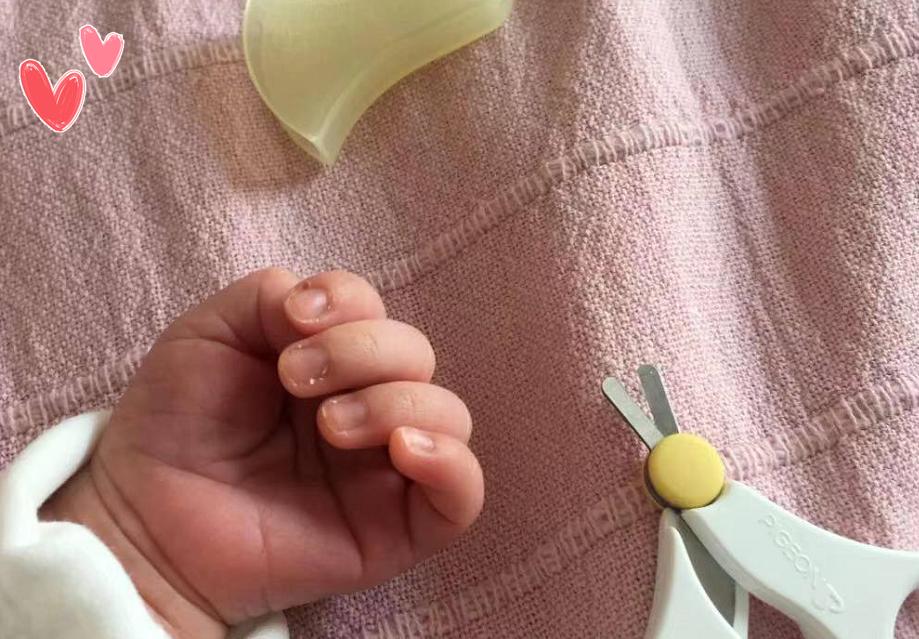 孩子手上老是有倒刺是缺乏什么,手指起皮长倒刺是缺乏什么维生素