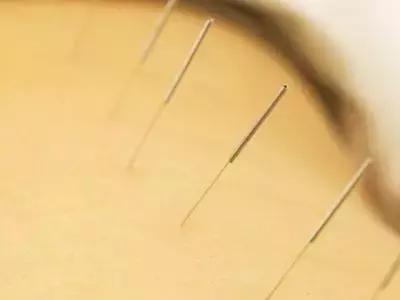 【原创科普】养出好卵子，你需要Get这些新技能！