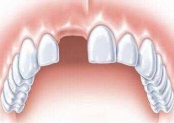 4种原因需警惕,哪些因素影响牙体色彩变化