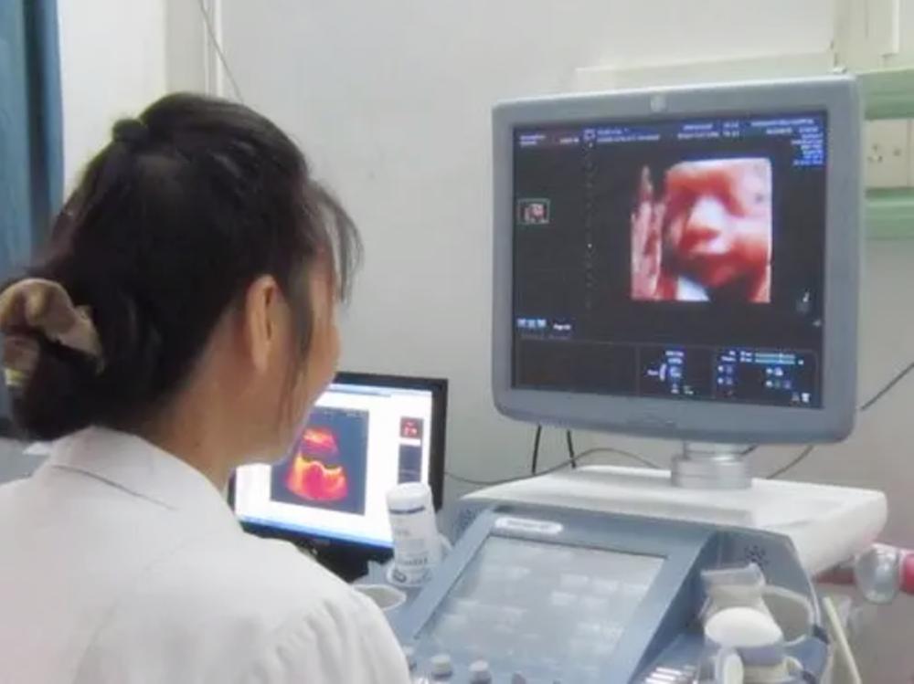 孕期几个月的四维照片最好看,孕期图片胎儿每个月