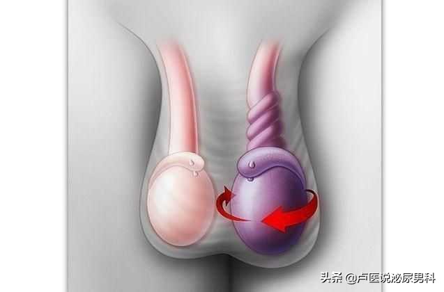 男子睾丸突然疼怎么回事,男子睾丸突然之间痛