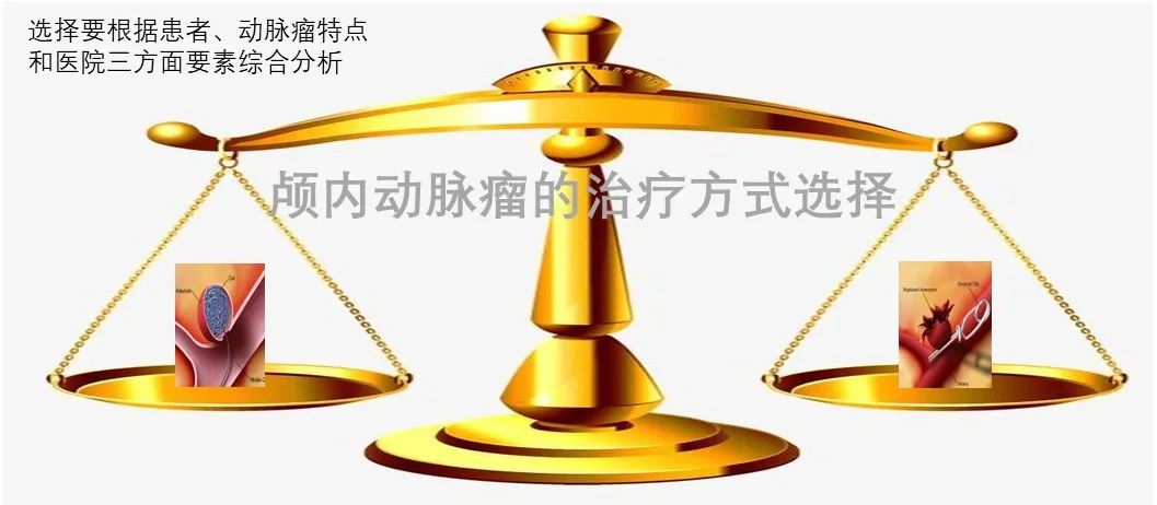 301医院颅内动脉瘤介入手术,颅内动脉瘤介入手术成功率