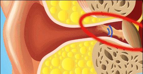 掏耳屎的学问,飞碟说掏耳屎的学问