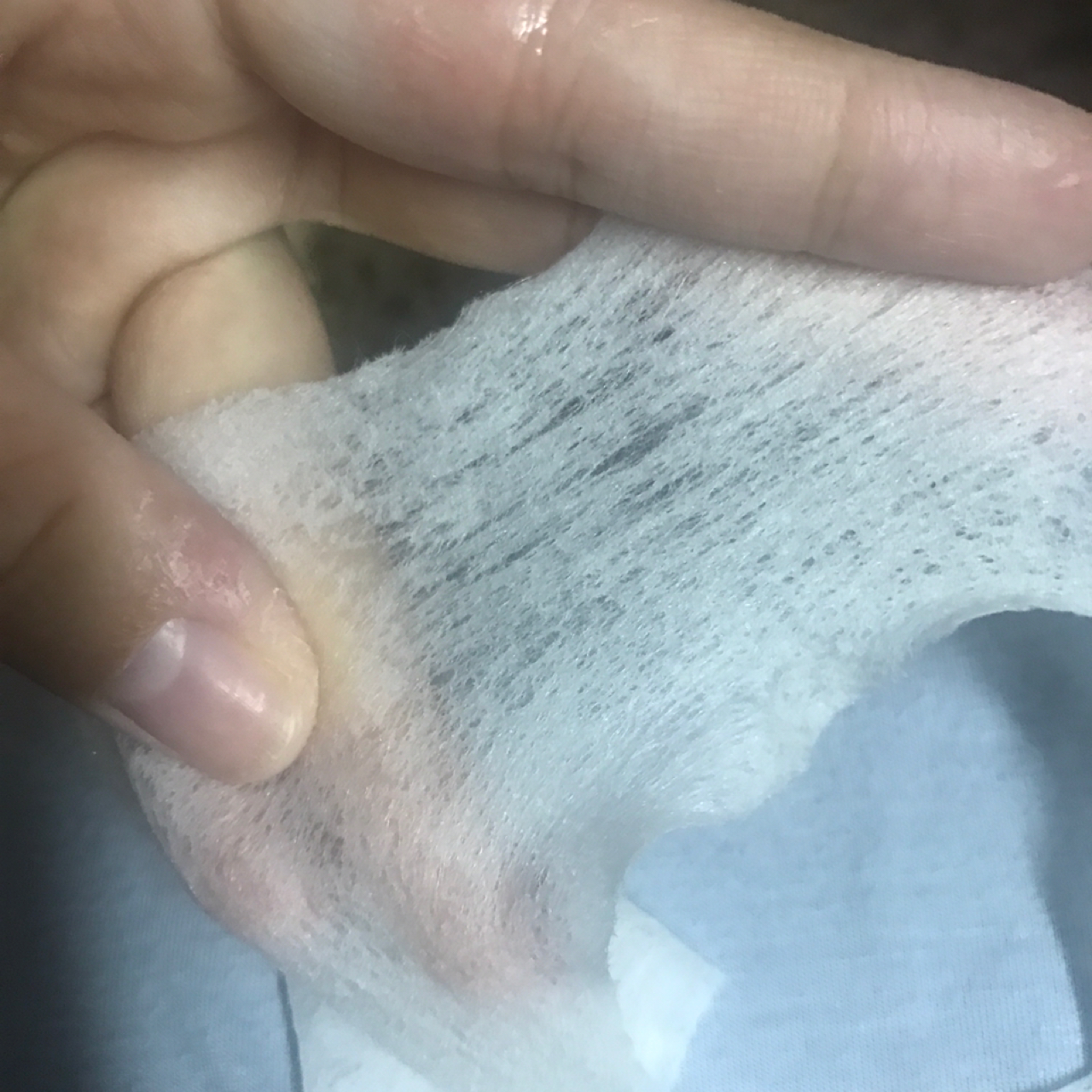 拯救痘痘肌肤的救星来啦,痘痘肌改善痘印产品推荐