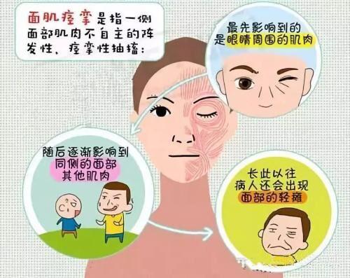 眼皮老是跳怎么回事？神经科医生：这个病要警惕了