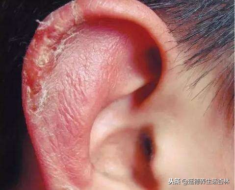 古代防寒神器,古代必备十大神药