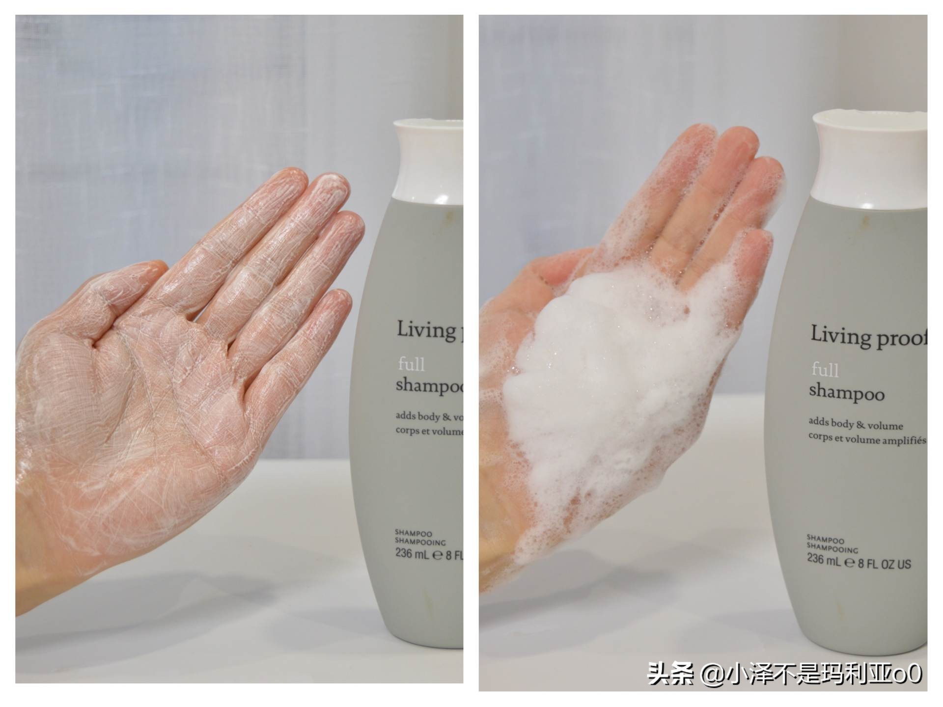 额头秃发际线后移适合什么洗发水,拯救发际线的洗发水