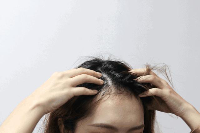 白头发长期吃什么头发可以变黑,头顶白发吃什么可以改善白头发