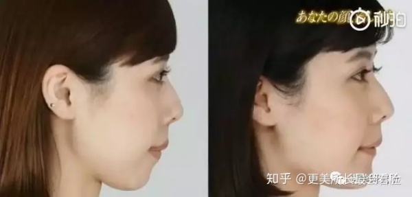 好看的侧脸要符合哪些条件,好看的侧脸的标准