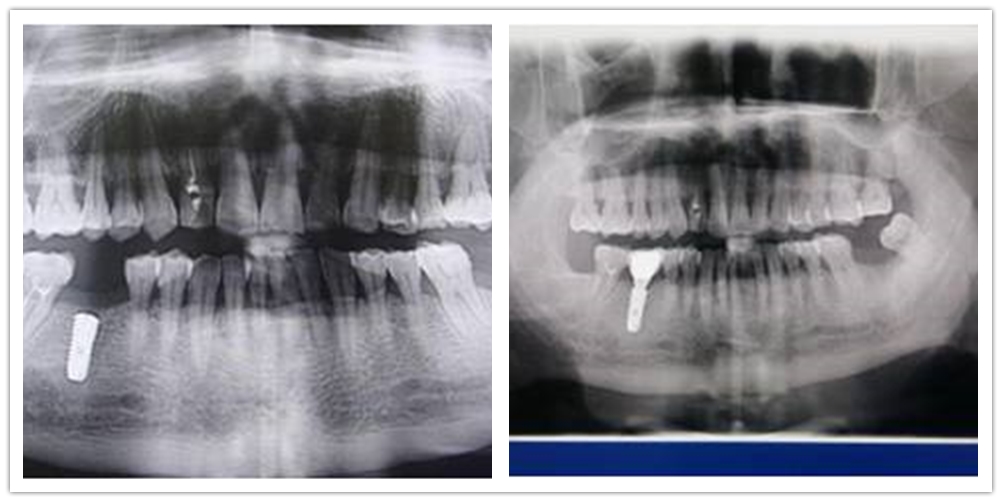 口腔科诊疗指南及技术操作常规,口腔科疾病的最新诊疗护理措施