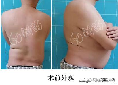 求医之路艰难的感慨,漫漫求医路感慨