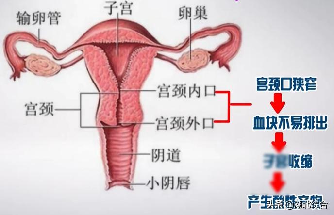痛经有血块怎么调理和改善,痛经一直疼有血块怎么调理