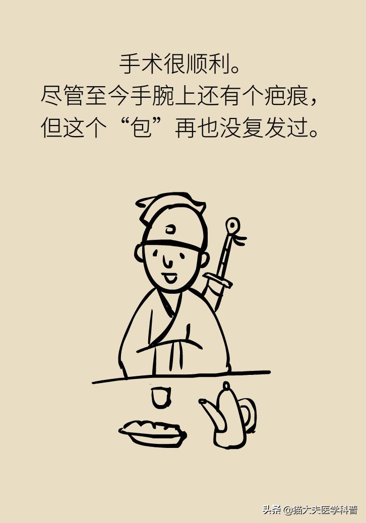 手腕长腱鞘囊肿,手腕上有个凸起的包腱鞘囊肿