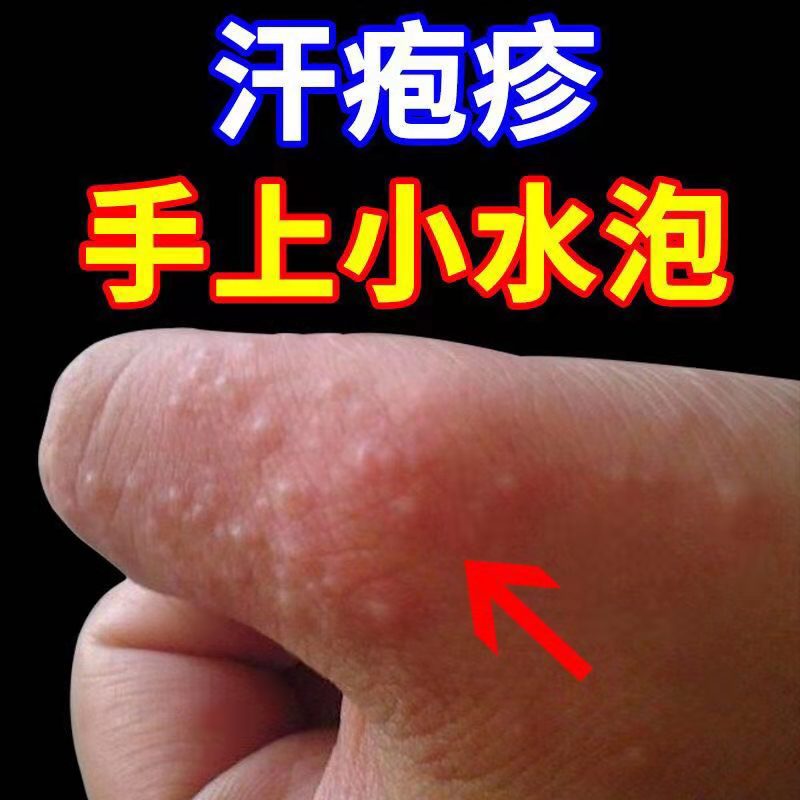 脚趾缝里面长个黄色水泡超级痒,脚趾缝长水泡脚趾缝糜烂奇痒无比