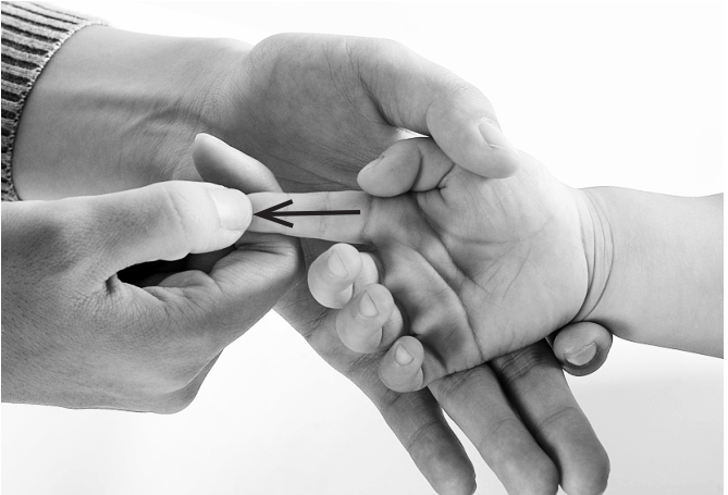 小儿感冒夹惊机制,小孩发烧惊风中医调理