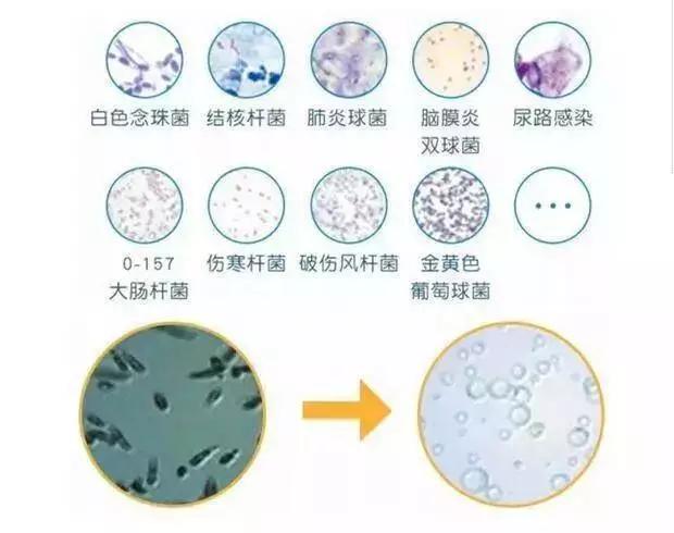 各种顽固污渍和铁锈洗衣神器,教你在家制作懒人洗衣神器