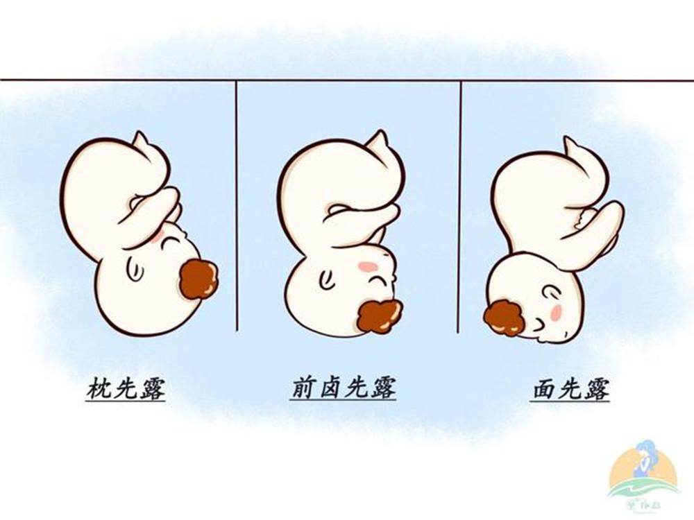 胎位不正的原因和注意事项,胎位不正最佳调整方法