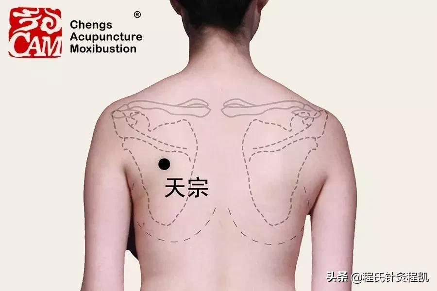 乳腺增生乳房胀痛别乱用药,经期乳腺增生疼怎么缓解