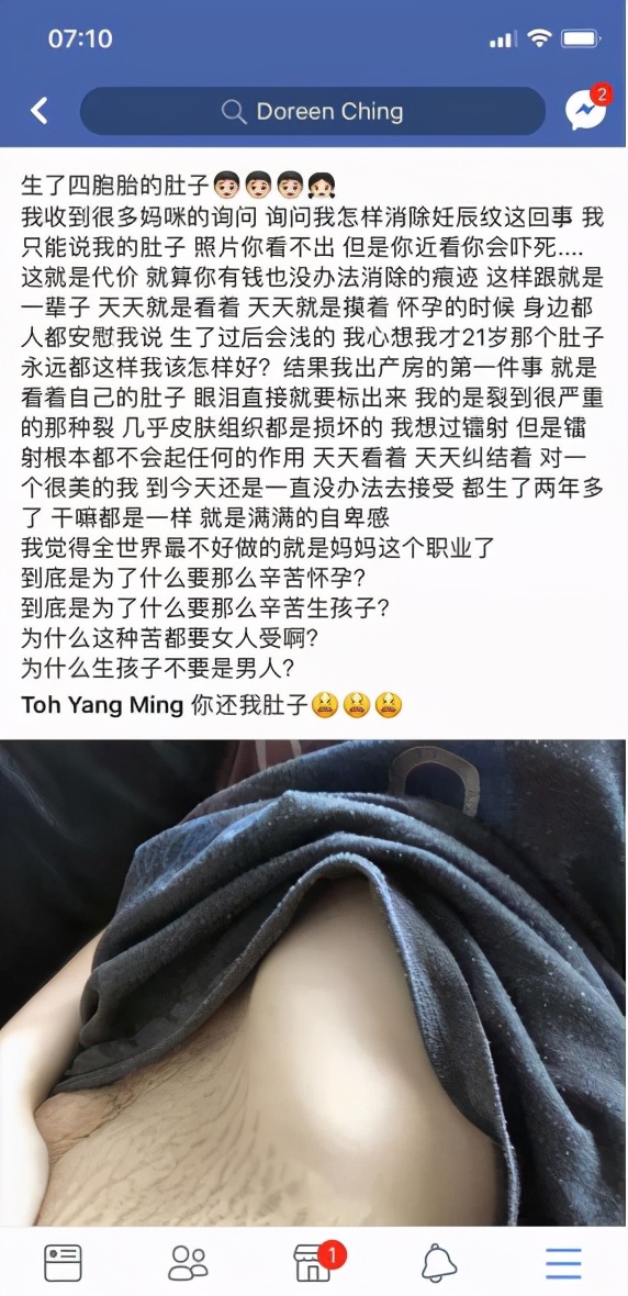 生产图鉴|生孩子，到底要经历多少难以启齿的尴尬与痛苦？