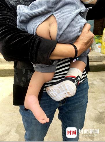 产检正常生下畸形宝宝是谁的责任,产检正常生下畸形宝宝打官司