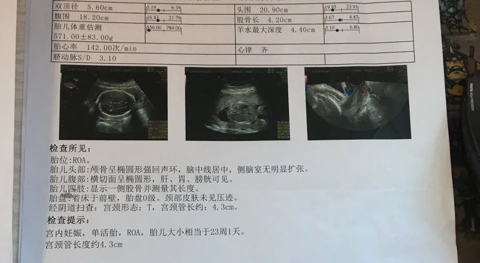 孕期一共做几次b超检查,孕期需要做几次b超检查