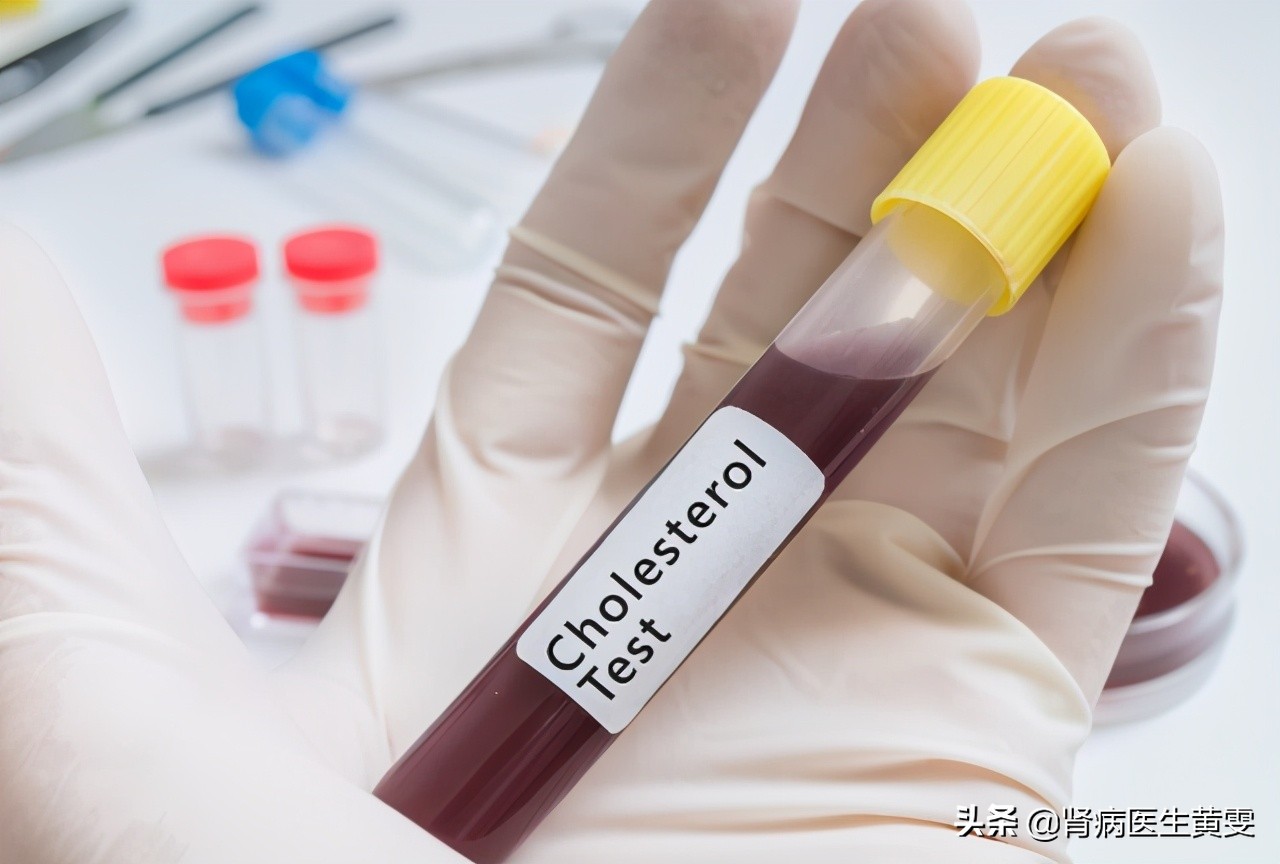 肾衰治疗一个月肌酐570降到400,慢性肾炎长期用药控制会肾衰吗