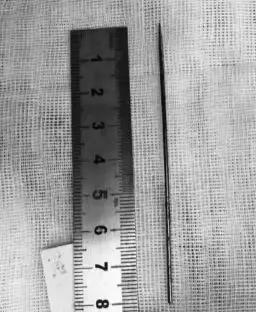 小孩鼻子塞进异物出血怎么处理,小孩耳朵塞进异物流血