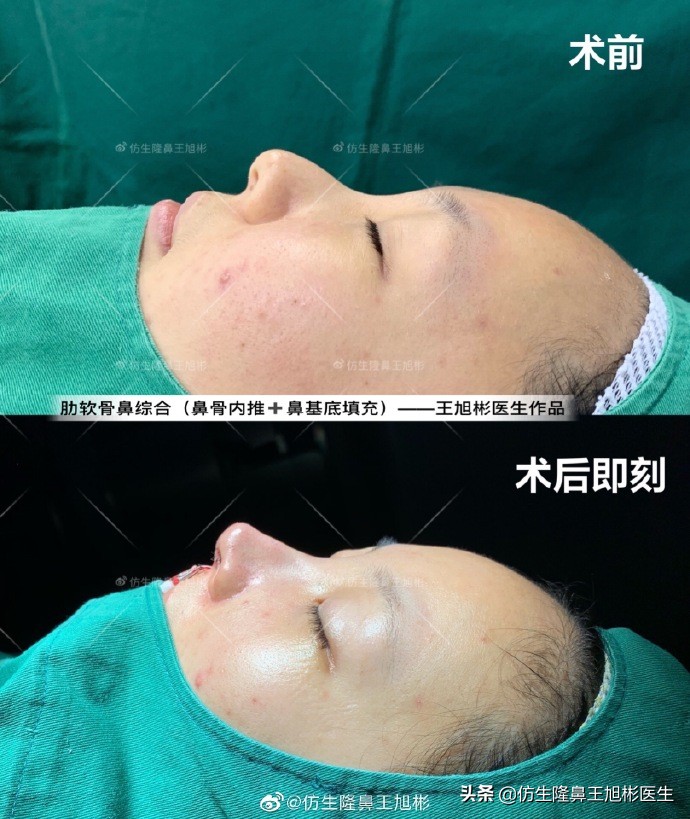 长文+多案例预警！我们所说的「幼态鼻」，到底“幼”从何来？