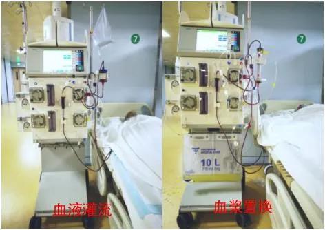 血液净化技术在急性中毒中的应用,血液净化机器治疗血液中毒