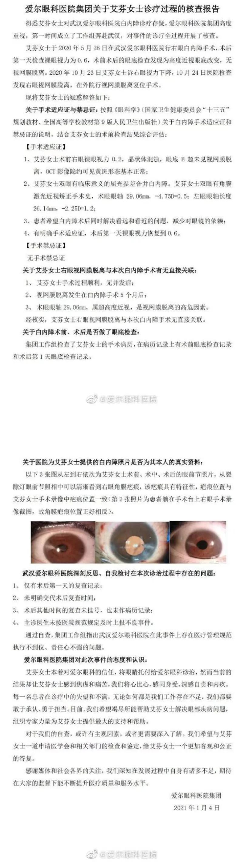 爱尔眼科在眼科行业到底厉不厉害,爱尔眼科未来可期