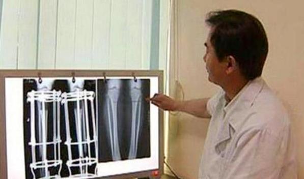 未来可能实现的成人增高方法,科学的成人增高方法