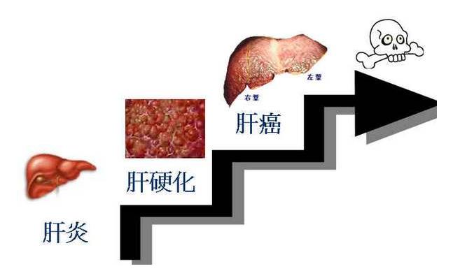 解读肝癌外科治疗中的重要问题,关于肝癌介入治疗的常见疑惑
