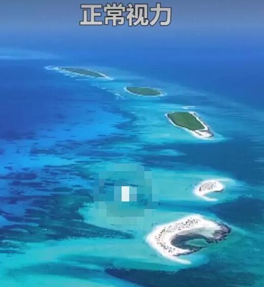 近视究竟是如何发展的,近视到底多可怕