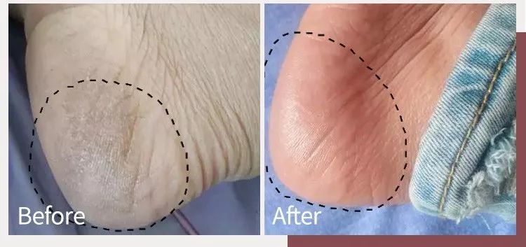 蔡依林护肤视频,蔡依林皮肤特护霜