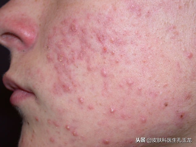 微量元素锌有什么作用,人体对微量元素锌的吸收率高吗