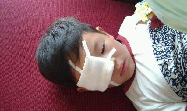 宝宝眼睛进灰了怎么办,石灰进入眼睛后失明是永久的吗