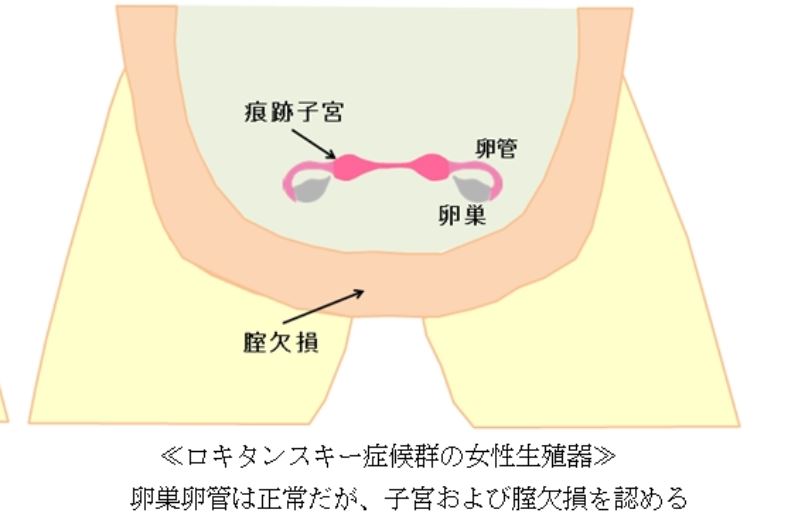 结婚四年的日本夫妇,妻子隐瞒自己没有子宫!坦白后丈夫如此反应