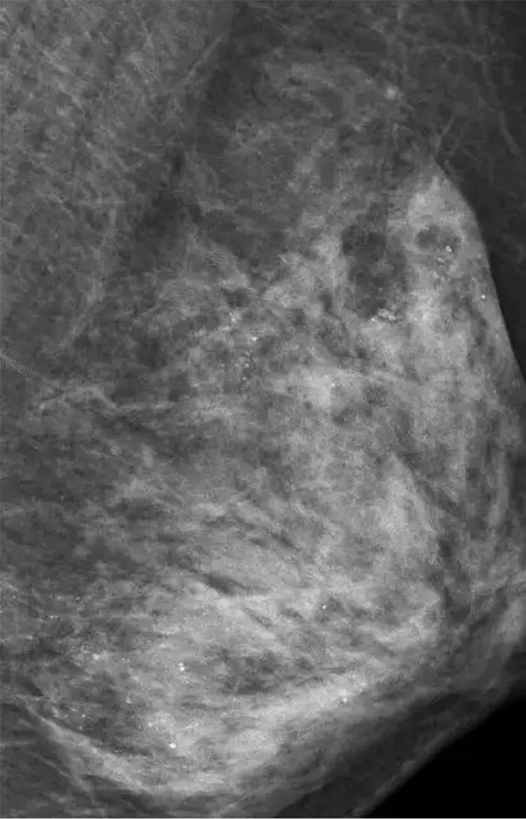 胸部按摩对乳房有帮助吗,乳房是不是要定期按摩